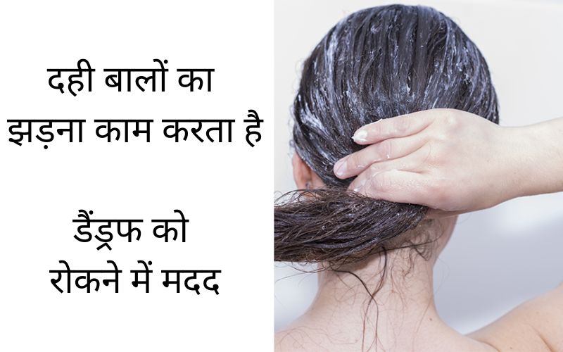 curd benefits in hair and dendruff